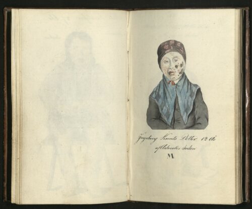Portrait of Ingeborg Knuts Dotter, 12 years old. © Image courtesy of the Hagströmer Medico-Historical Library, Karolinska Institutet.