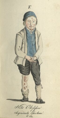 Portrait of Nils Olofsson, 15 years old. © Image courtesy of the Hagströmer Medico-Historical Library, Karolinska Institutet.